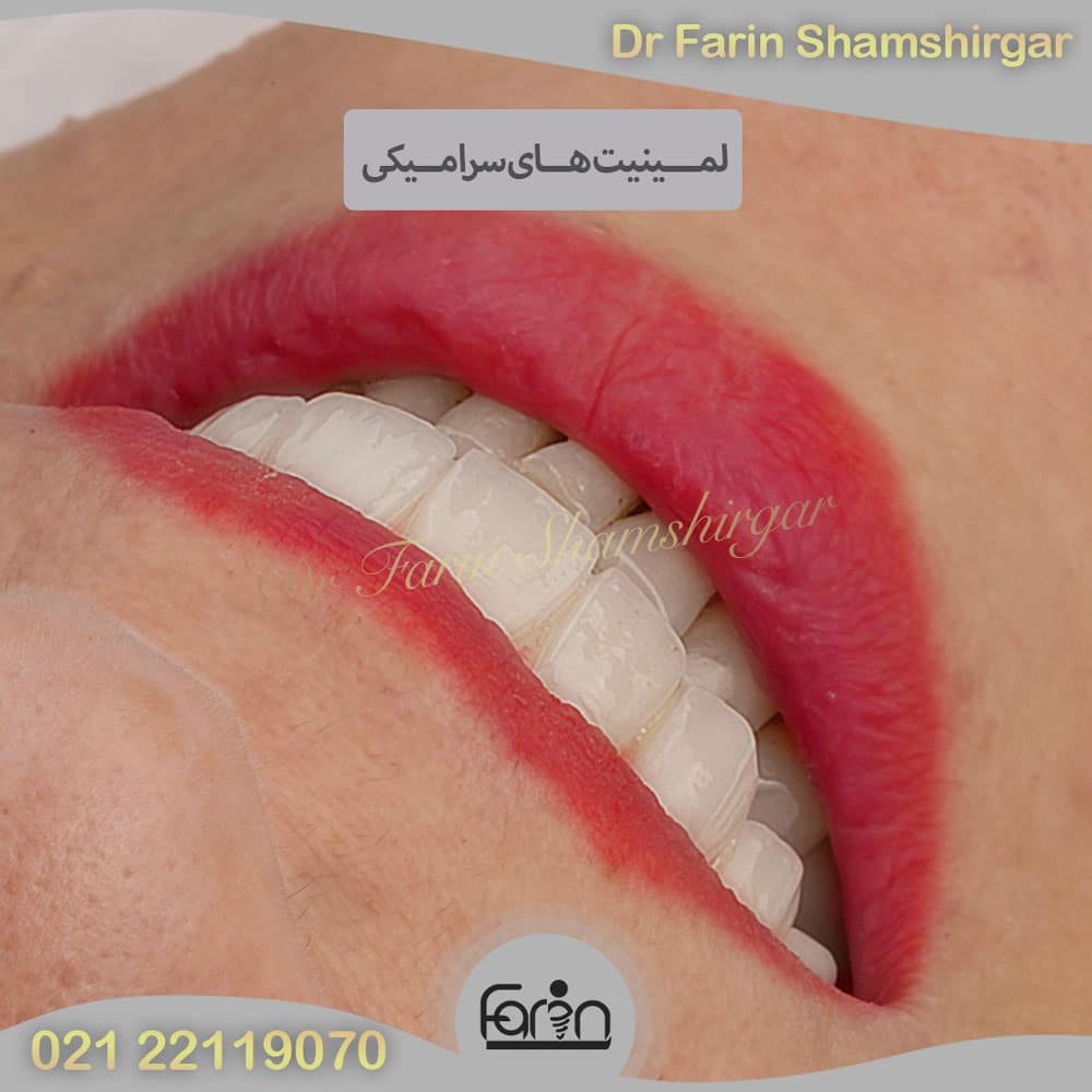 بهترین متخصص پروتز دندان در زعفرانیه