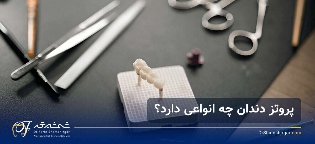 بهترین متخصص پروتز دندان در زعفرانیه