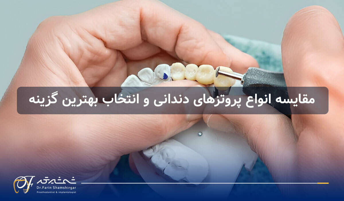 پروتز دندان