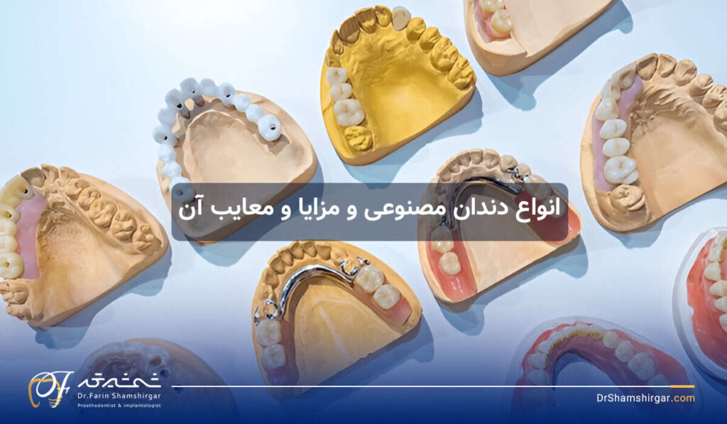 دنچر یا دندان مصنوعی
