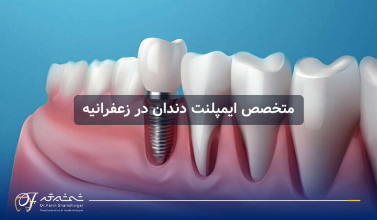 ایمپلنت دندان برای چه کسانی مناسب است