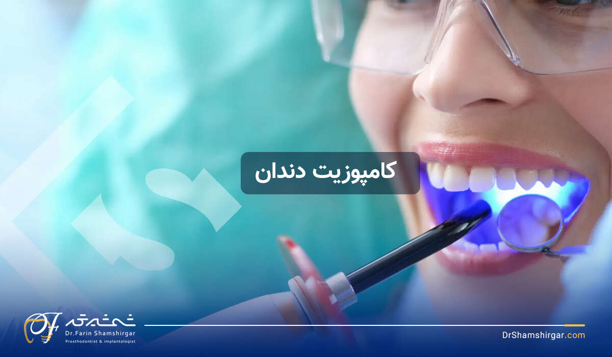 کامپوزیت دندان