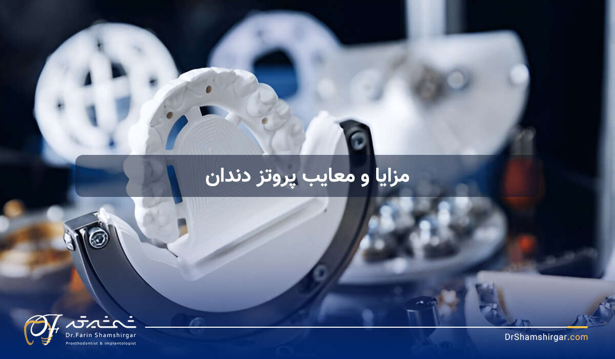 مزایا و معایب پروتز دندان