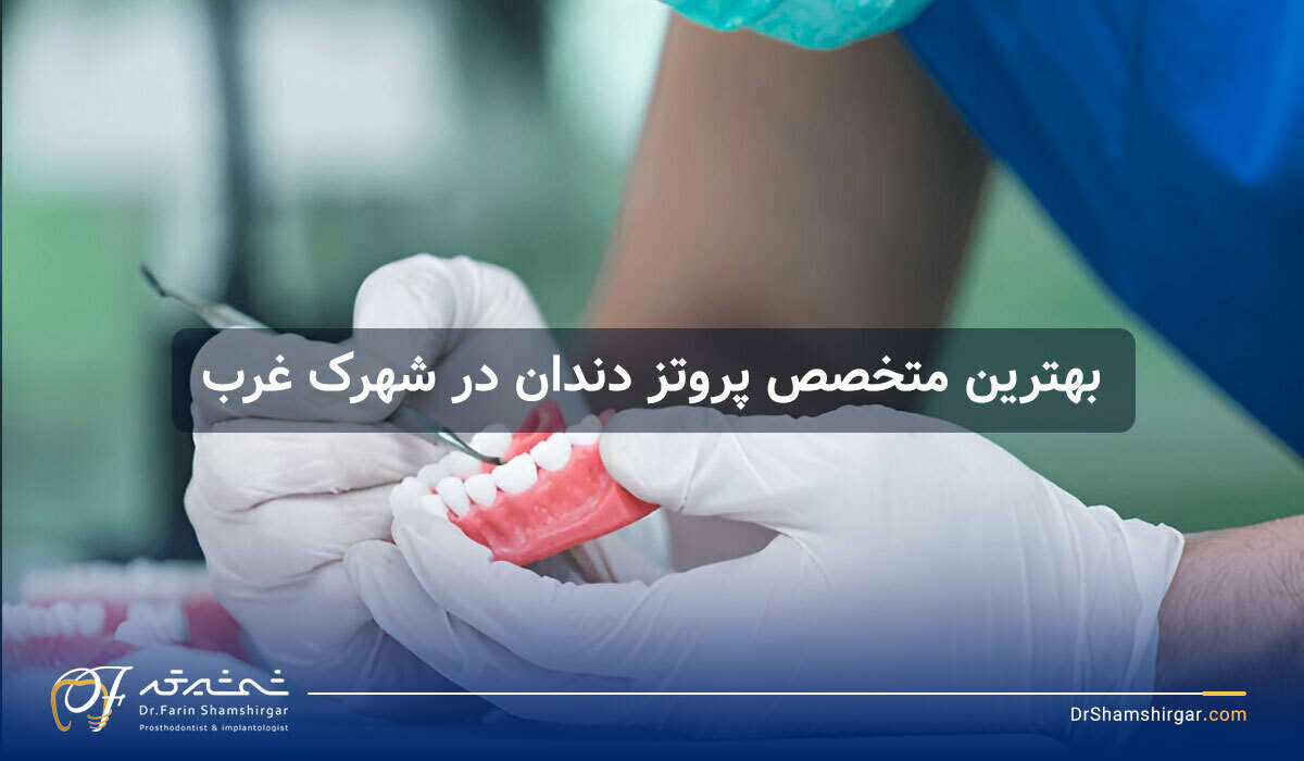 متخصص پروتز دندان در شهرک غرب
