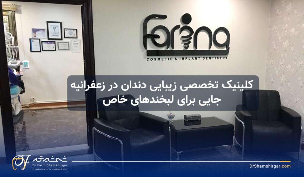 لیفت لثه