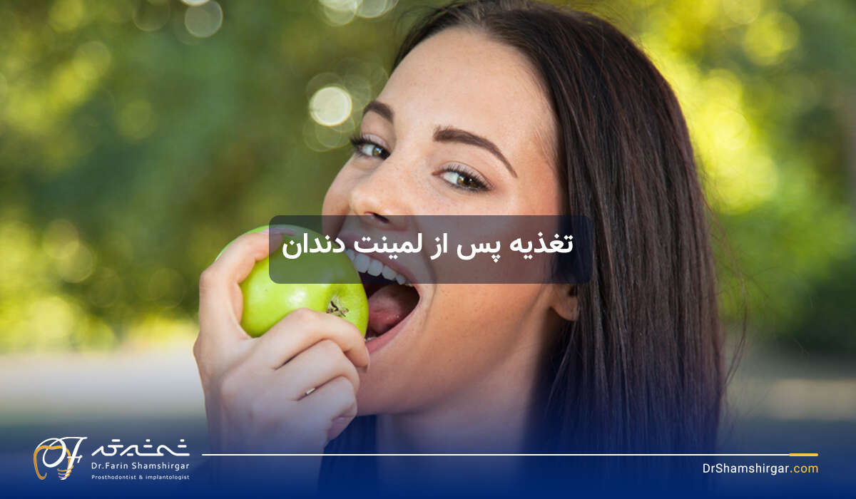 مراقبت های بعد از لمینت دندان