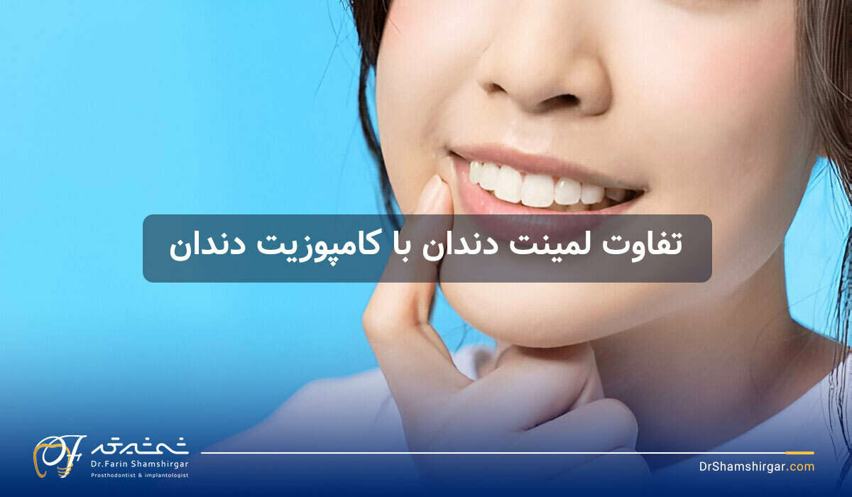 تفاوت لمینت دندان و کامپوزیت دندان