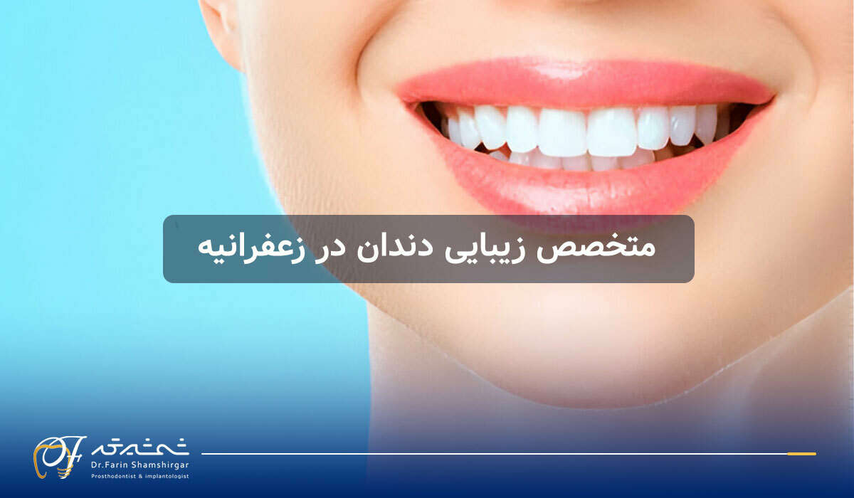 انواع اوردنچر