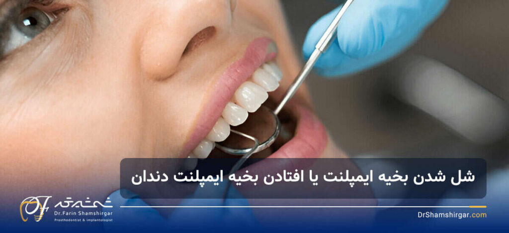 بخیه ایمپلنت دندان