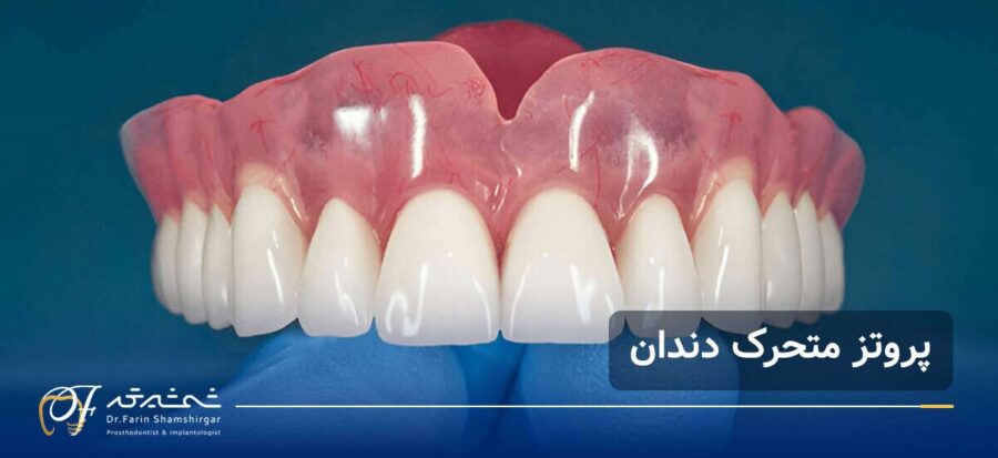 بهترین متخصص پروتز دندان در زعفرانیه