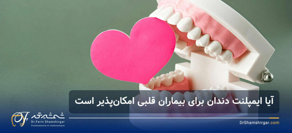 ایمپلنت دندان برای بیماران قلبی