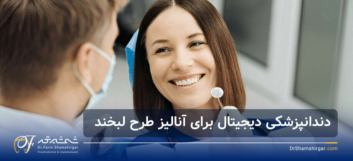 آنالیز طرح لبخند