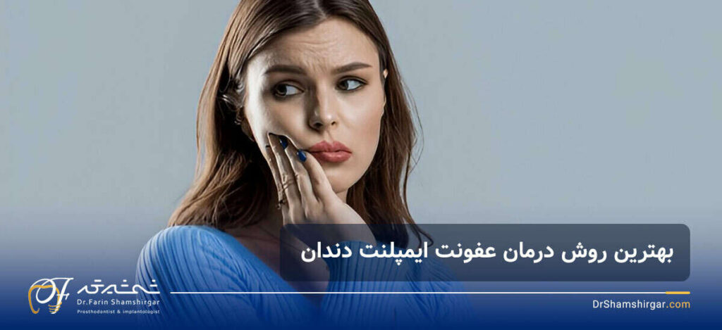 عفونت ایمپلنت دندان