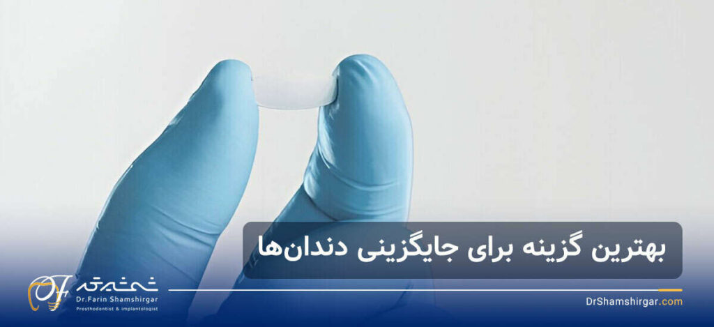کاشت دندان بدون ایمپلنت