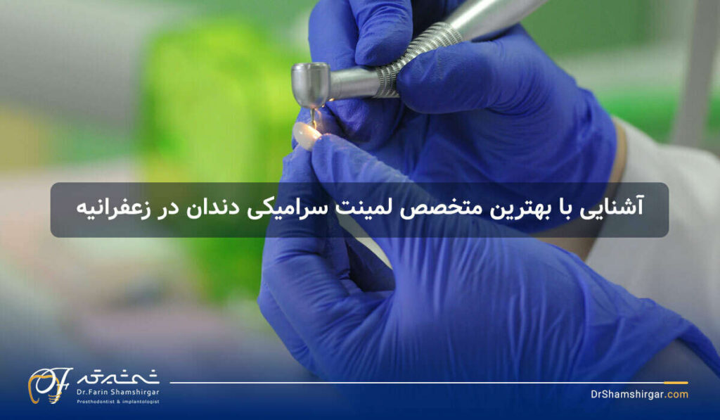 عوارض لمینت دندان
