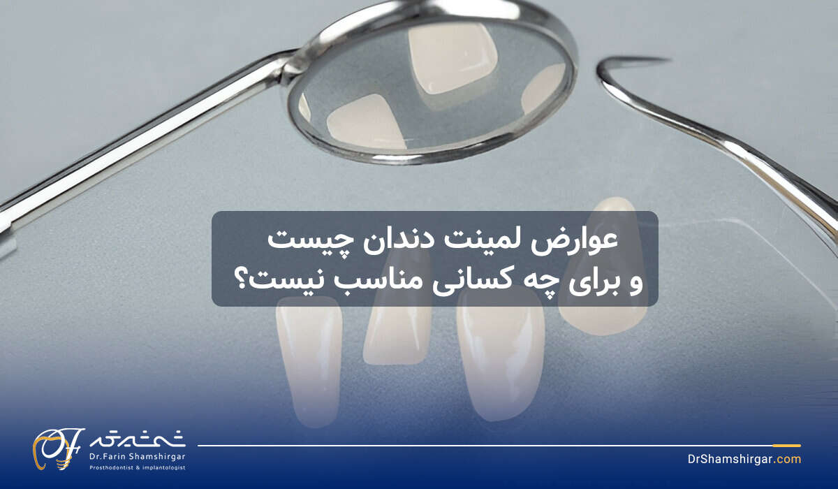 عوارض لمینت دندان